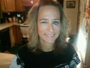 A face plant on the second lap of the course gave Barb a black eye and a swollen lip, plus several other bruises.